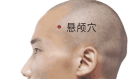 懸顱穴的功效作用以及刺灸法懸顱穴治療偏頭痛! 懸顱穴穴位