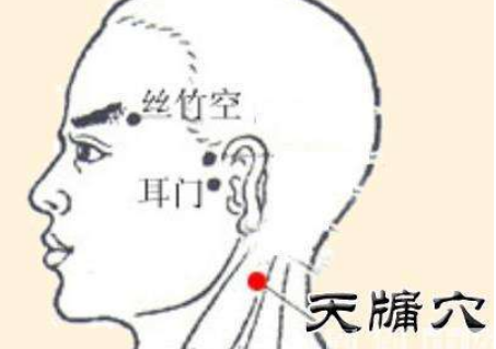 天牖穴的功效作用以及按摩天牖穴治療頭痛頭暈! 天牖穴